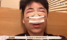 整形爆料视频大全集最新,最新爆料视频大全集深度解析