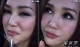 整形爆料视频大全集最新,最新爆料视频大全集深度解析